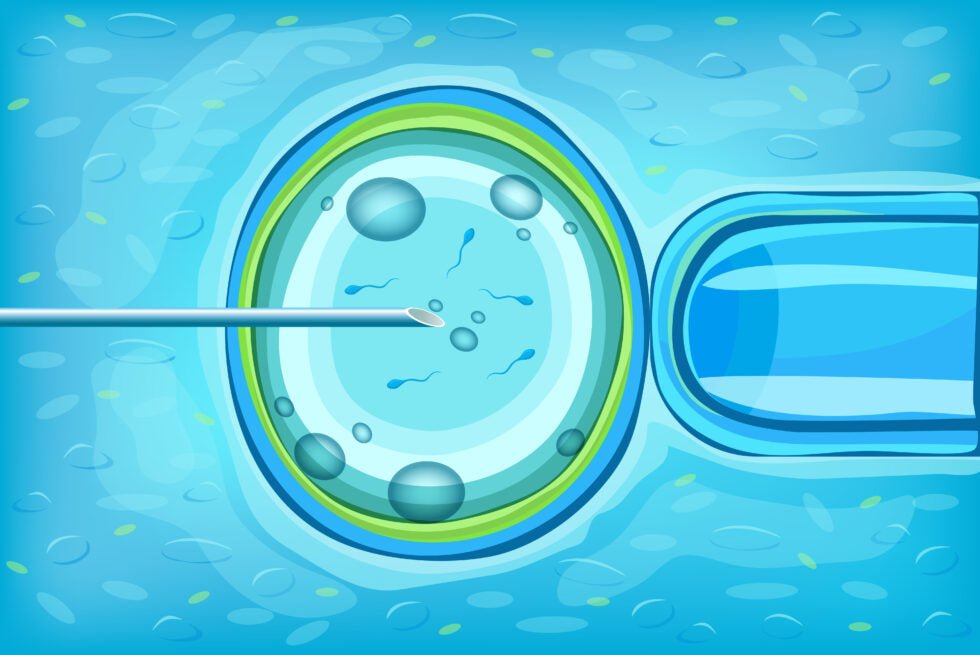 Fecundación in vitro: qué es y en qué consiste - Motherna
